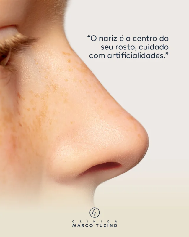 O nariz é o ponto de equilíbrio do rosto — sutil, mas essencial. Em tempos de excessos, escolher a naturalidade é um ato de respeito com a sua identidade. 👃🏼

Harmonizar não é transformar, é adequar. Evite exageros!

Me conta, você tem vontade de realizar o sonho da sua rinoplastia mas tem medo do resultado ficar artificial? Na consulta nós buscamos fazer um planejamento detalhado de acordo com o formato do seu rosto e assim garantir um resultado natural e harmônico.

Agende a sua consulta através do link na bio!