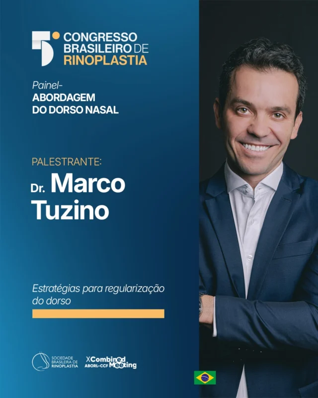 É com grande satisfação que divido com vocês que serei palestrante no 5º Congresso Brasileiro de Rinoplastia, no Rio de Janeiro. 📑✨

O tema da minha conferência será "Estratégias para regularização do dorso".

Estar entre grandes nomes debatendo a Rinoplastia é o reflexo do meu compromisso em entregar uma experiência sempre diferenciada e de padrão internacional.

Nos vemos nos dias 04, 05 e 06 de junho. 🚀

Acompanhe os bastidores desse grande evento por aqui. 

@sociedade_br_rinoplastia 

#DrMarcoTuzino #Rinoplastia #RinoplastiaEstruturada #CongressoRinoplastia #ExcelenciaMedica