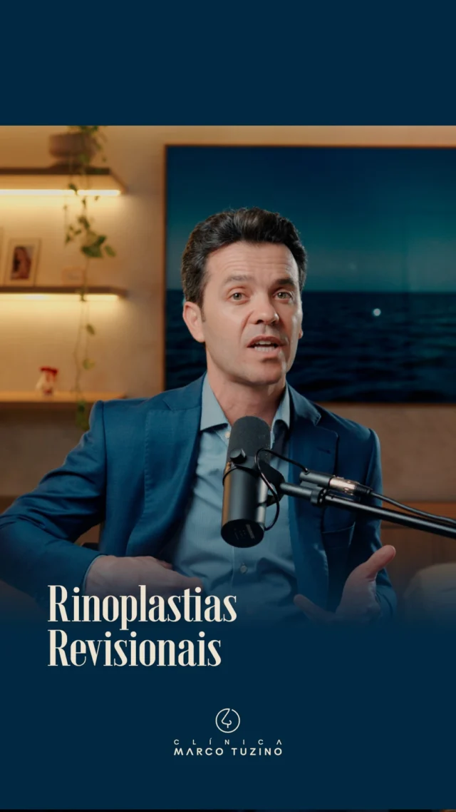 A Rinoplastia Revisional exige muito mais do que técnica, exige sensibilidade para devolver a harmonia facial e a autoestima de quem não alcançou o resultado desejado na primeira cirurgia. 🩺✨

No vídeo de hoje, mostro como o planejamento minucioso e a Rinoplastia Estruturada são fundamentais para resgatar a naturalidade que você sempre buscou.

Assista o vídeo para entender como funciona a abordagem cirúrgica em casos revisionais e tire suas dúvidas nos comentários! 👇

#DrMarcoTuzino #RinoplastiaRevisional #Rinoplastia