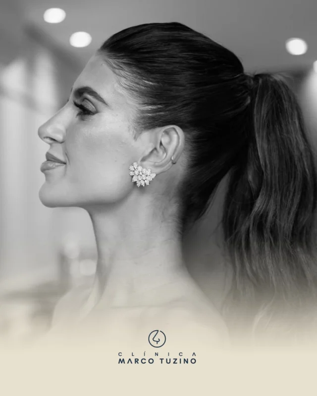 NATURALIDADE 🥰

👃
👃🏻
👃🏼
👃🏽
👃🏾
👃🏿

#DrMarcoTuzino #Rinoplastia